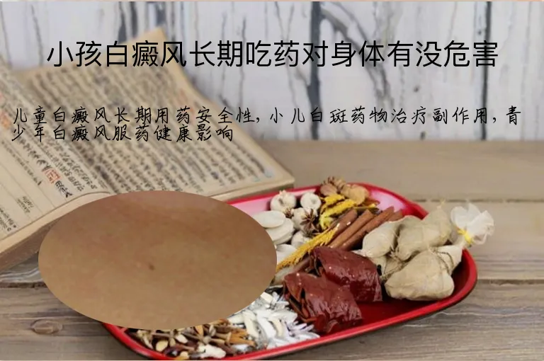 小孩白癜风长期吃药对身体有没危害