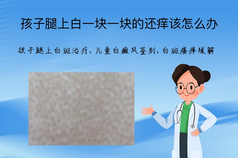 孩子腿上白一块一块的还痒该怎么办