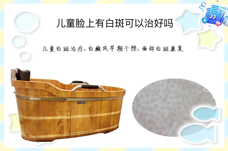 儿童脸上有白斑可以治好吗