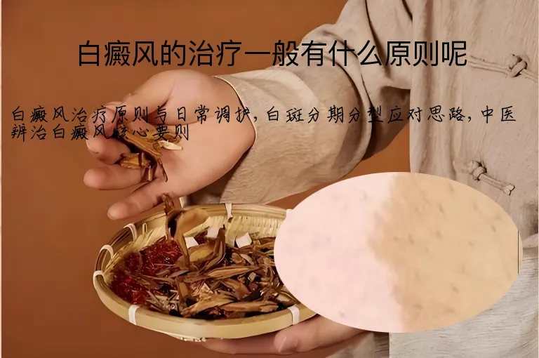 白癜风的治疗一般有什么原则呢