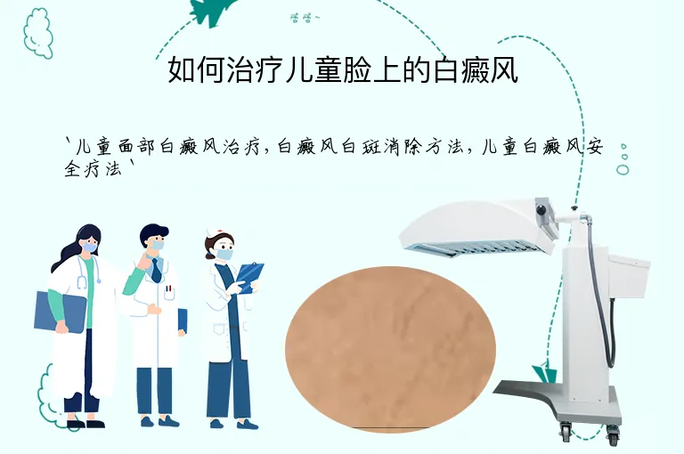 如何治疗儿童脸上的白癜风