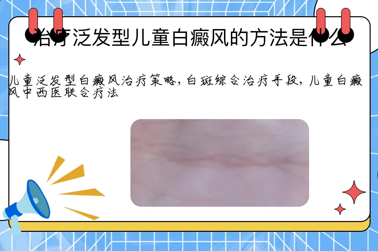治疗泛发型儿童白癜风的方法是什么