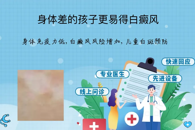 身体差的孩子更易得白癜风