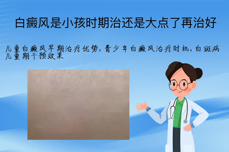 白癜风是小孩时期治还是大点了再治好
