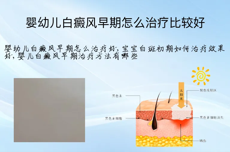 婴幼儿白癜风早期怎么治疗比较好
