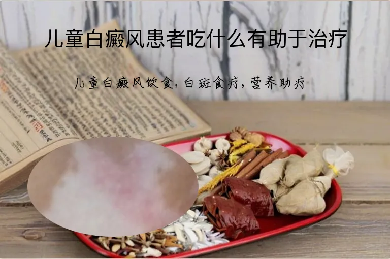 儿童白癜风患者吃什么有助于治疗