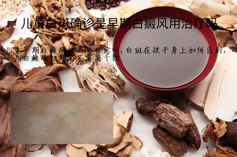 儿童白斑确诊是早期白癜风用治疗吗