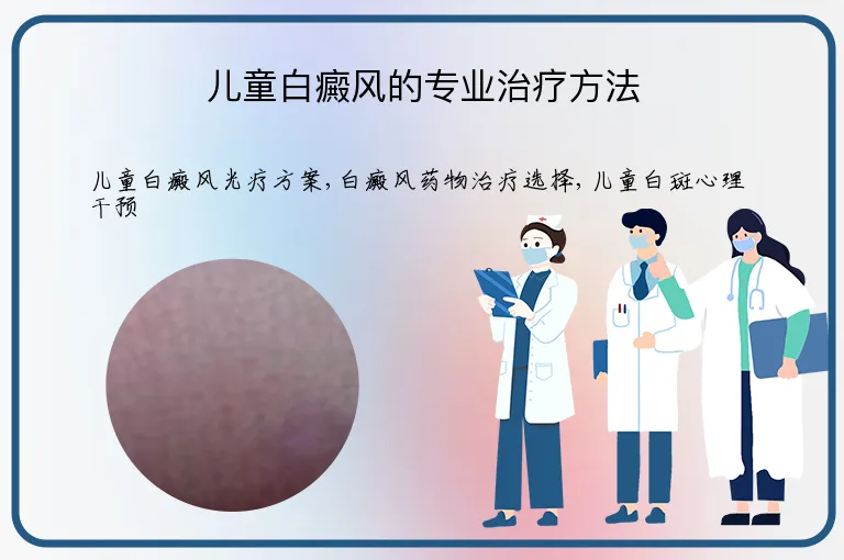 儿童白癜风的专业治疗方法