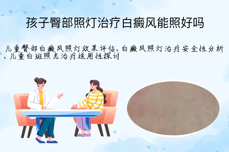 孩子臀部照灯治疗白癜风能照好吗