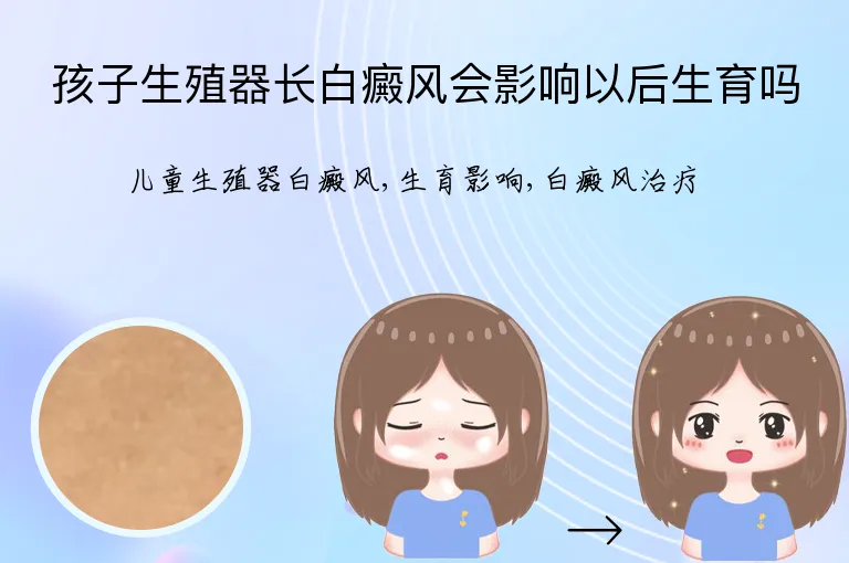 孩子生殖器长白癜风会影响以后生育吗