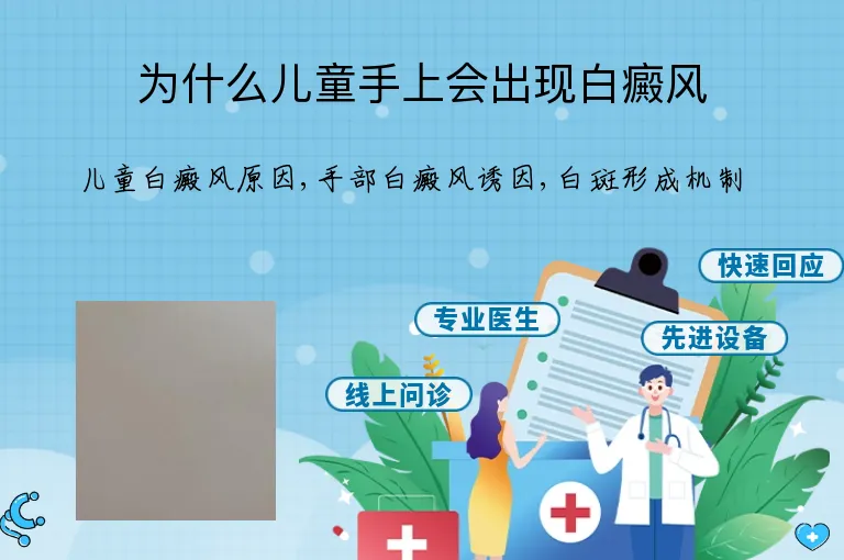 为什么儿童手上会出现白癜风