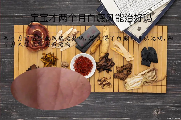 宝宝才两个月白癜风能治好吗