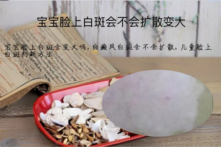 宝宝脸上白斑会不会扩散变大