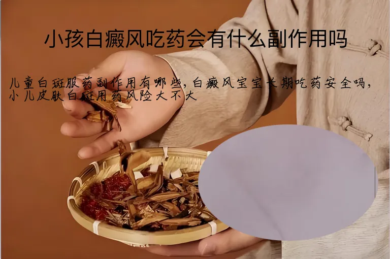小孩白癜风吃药会有什么副作用吗