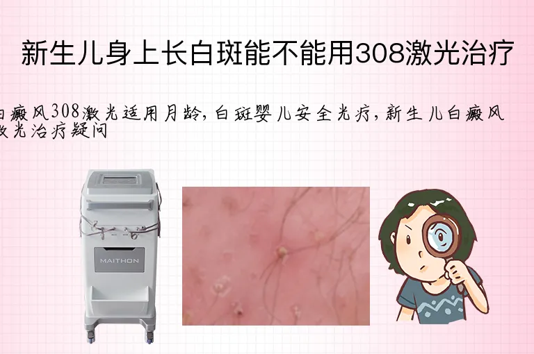 新生儿身上长白斑能不能用308激光治疗