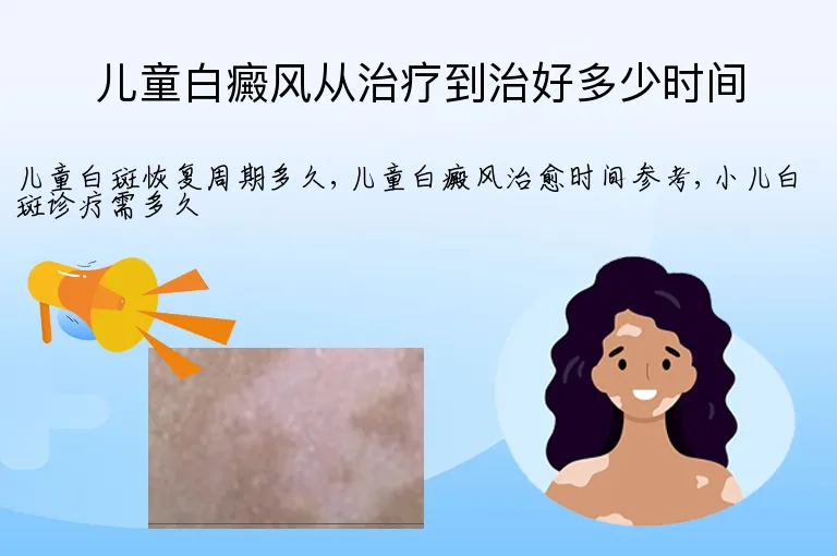 儿童白癜风从治疗到治好多少时间
