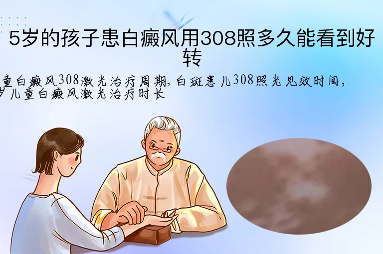 5岁的孩子患白癜风用308照多久能看到好转