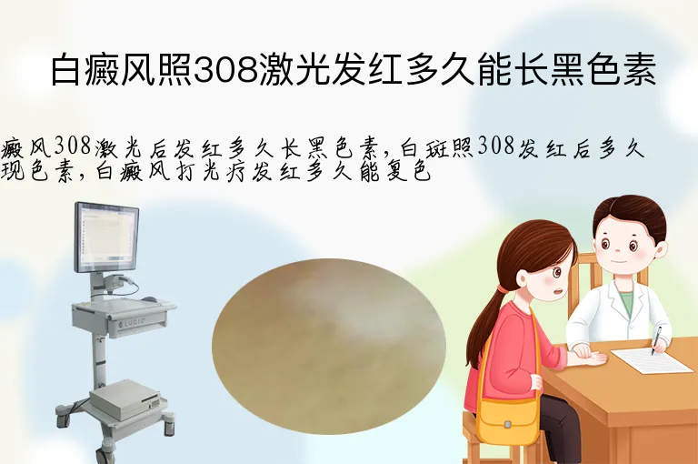 白癜风照308激光发红多久能长黑色素