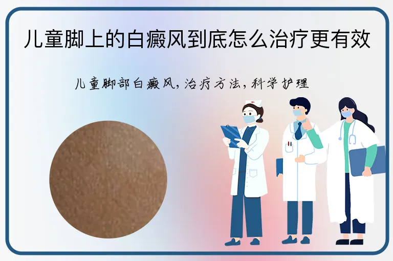 儿童脚上的白癜风到底怎么治疗更有效