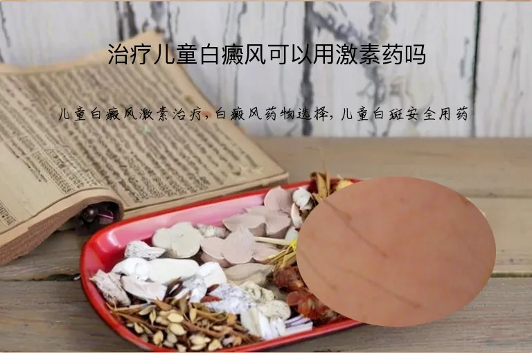 治疗儿童白癜风可以用激素药吗