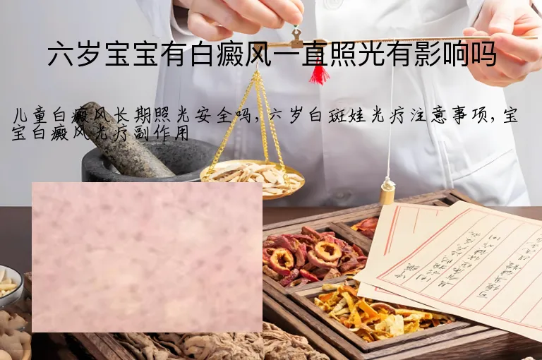 六岁宝宝有白癜风一直照光有影响吗