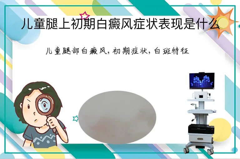 儿童腿上初期白癜风症状表现是什么