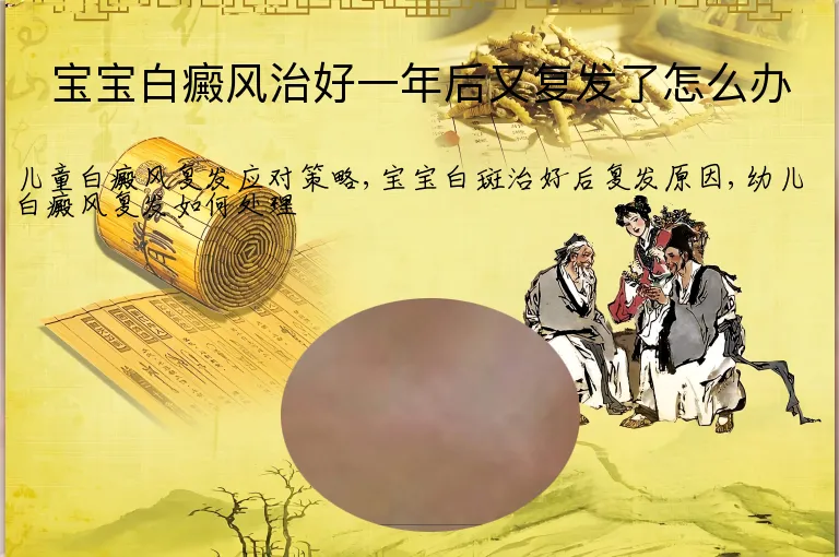 宝宝白癜风治好一年后又复发了怎么办