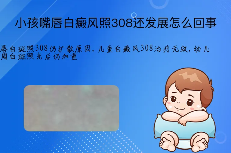 小孩嘴唇白癜风照308还发展怎么回事