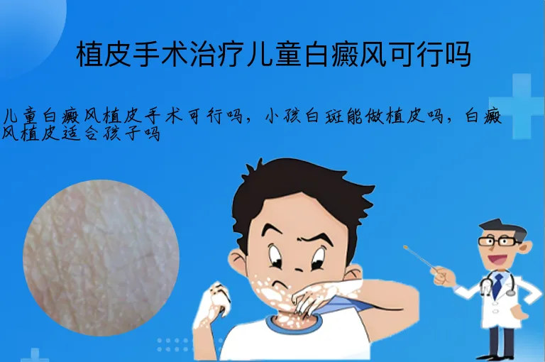 植皮手术治疗儿童白癜风可行吗
