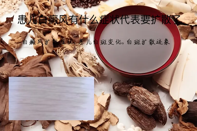 患儿白癜风有什么症状代表要扩散了