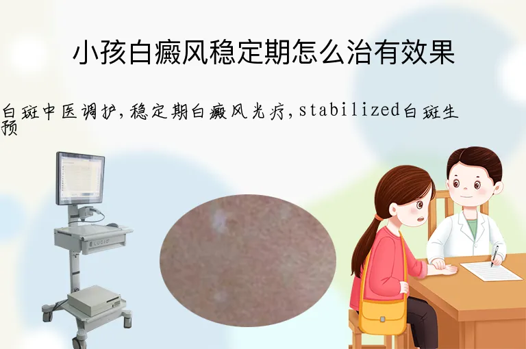 小孩白癜风稳定期怎么治有效果