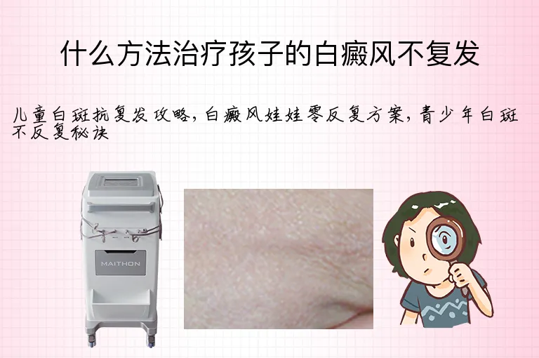 什么方法治疗孩子的白癜风不复发