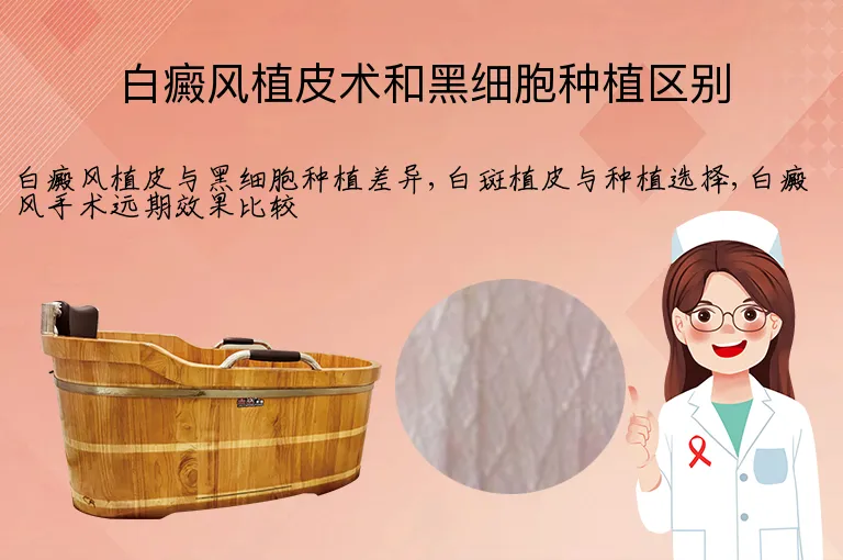 白癜风植皮术和黑细胞种植区别