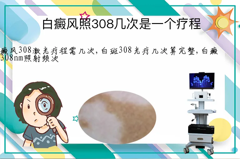 白癜风照308几次是一个疗程