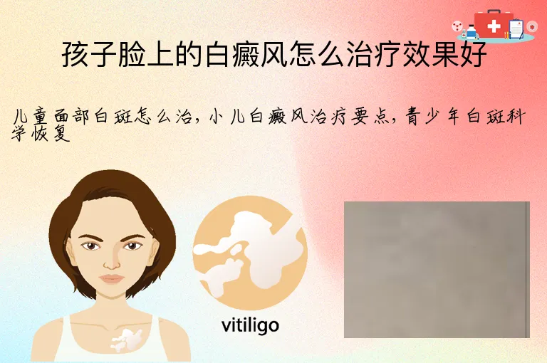 孩子脸上的白癜风怎么治疗效果好