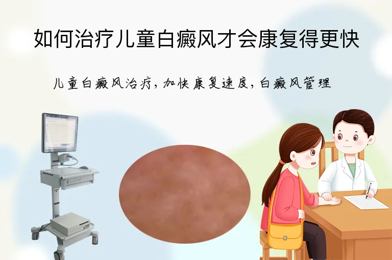 如何治疗儿童白癜风才会康复得更快