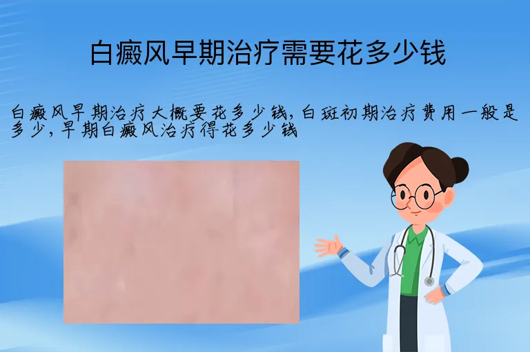 白癜风早期治疗需要花多少钱