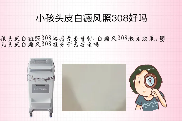 小孩头皮白癜风照308好吗