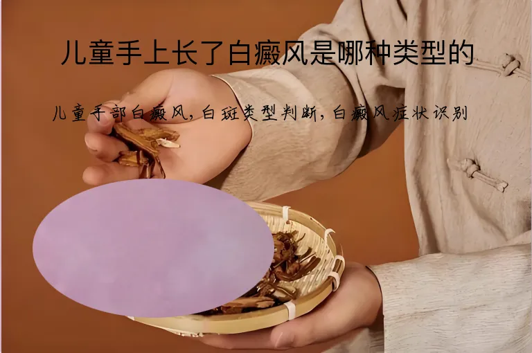 儿童手上长了白癜风是哪种类型的