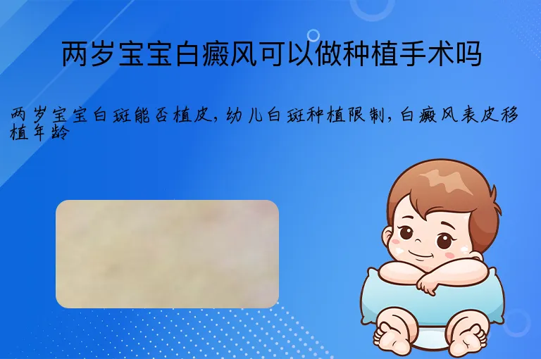 两岁宝宝白癜风可以做种植手术吗