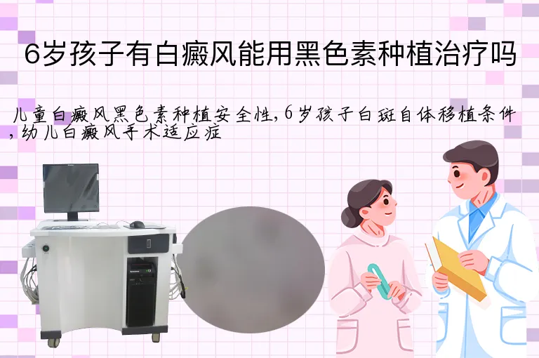 6岁孩子有白癜风能用黑色素种植治疗吗