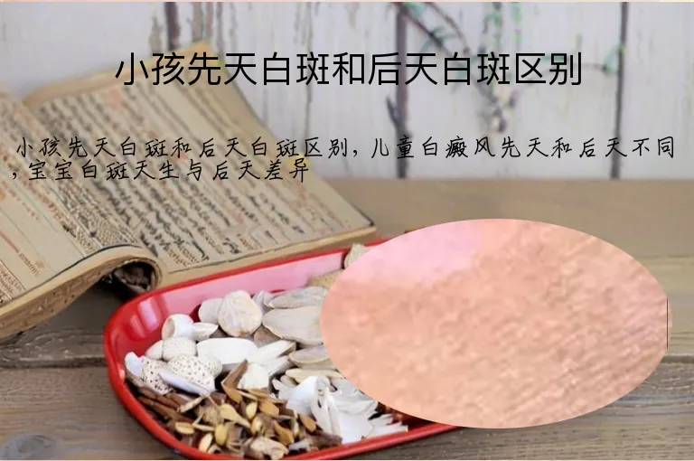 小孩先天白斑和后天白斑区别