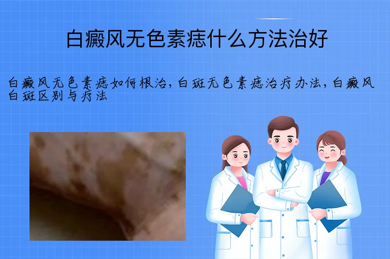 白癜风无色素痣什么方法治好