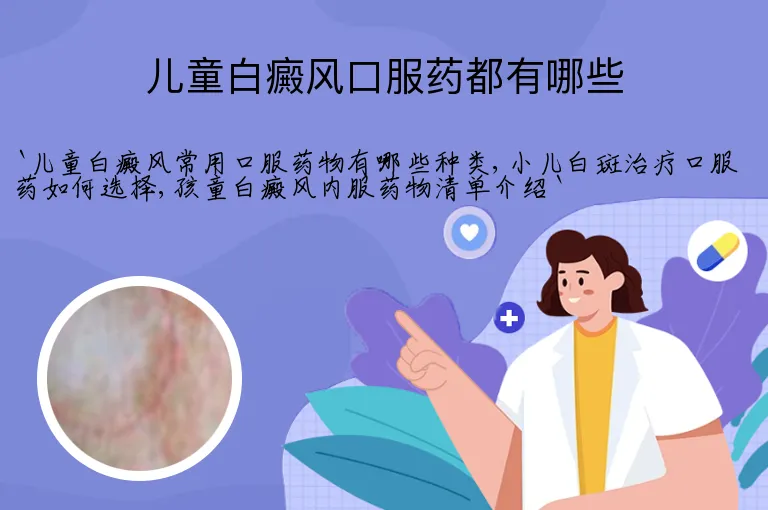 儿童白癜风口服药都有哪些
