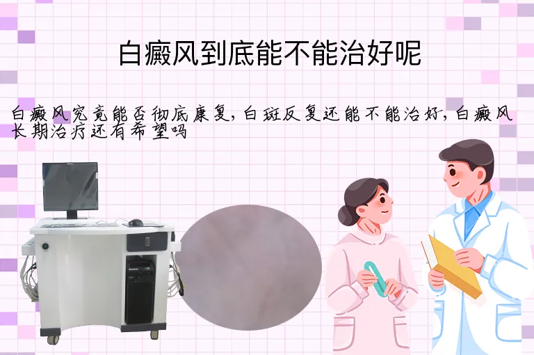 白癜风到底能不能治好呢