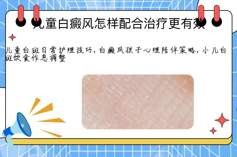 儿童白癜风怎样配合治疗更有效