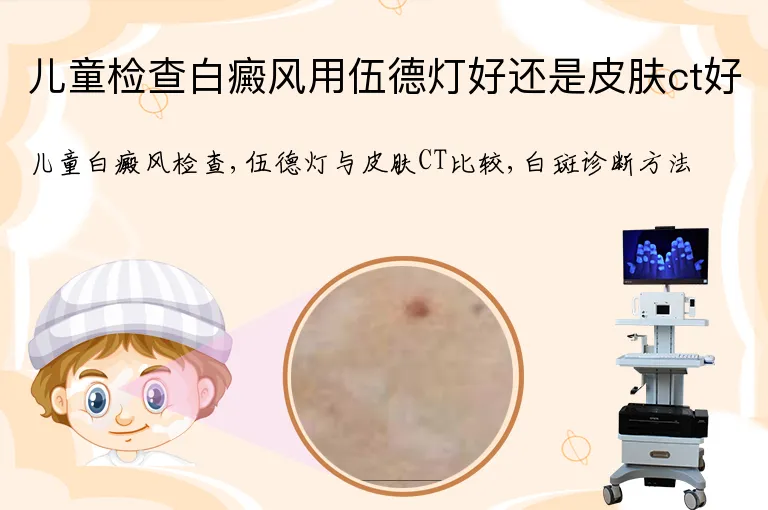 儿童检查白癜风用伍德灯好还是皮肤ct好