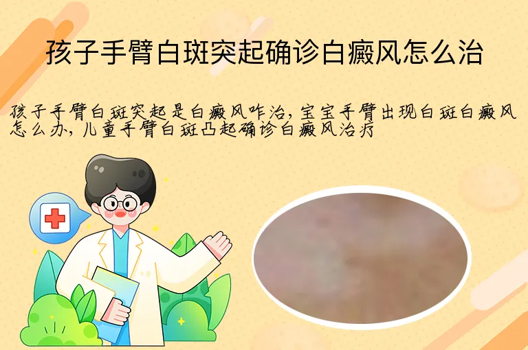 孩子手臂白斑突起确诊白癜风怎么治