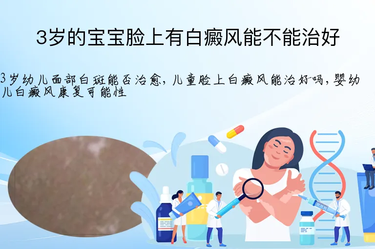 3岁的宝宝脸上有白癜风能不能治好