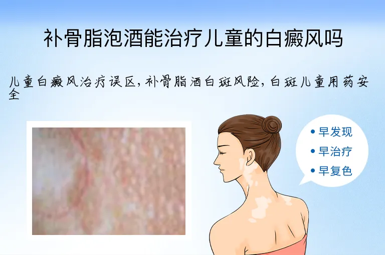 补骨脂泡酒能治疗儿童的白癜风吗